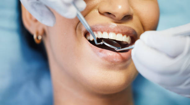 Best Chipped Tooth Repair Near Me  in Gilbert, MN